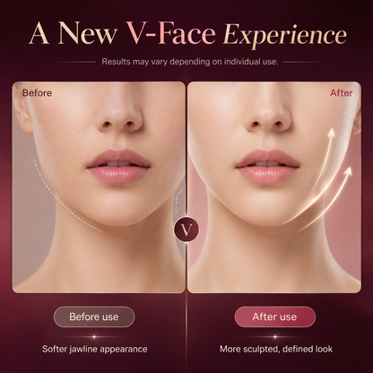 V-Line Pro LED Facial Lifting & Chin Contouring